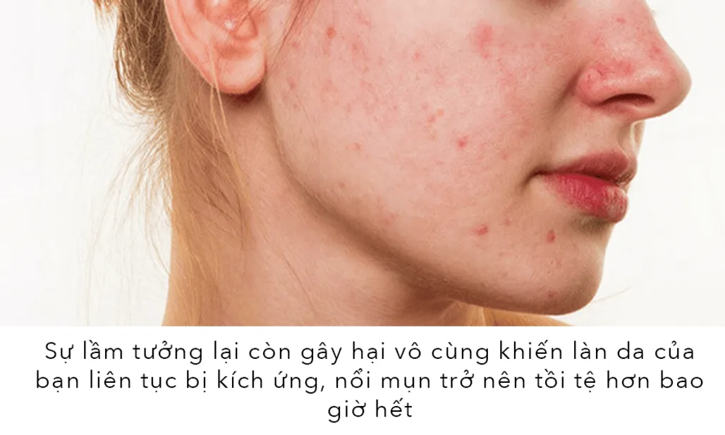 80% Con gái Việt nghĩ mình da dầu nhưng thật sự về việc dưỡng da sẽ khiến bạn kinh ngạc