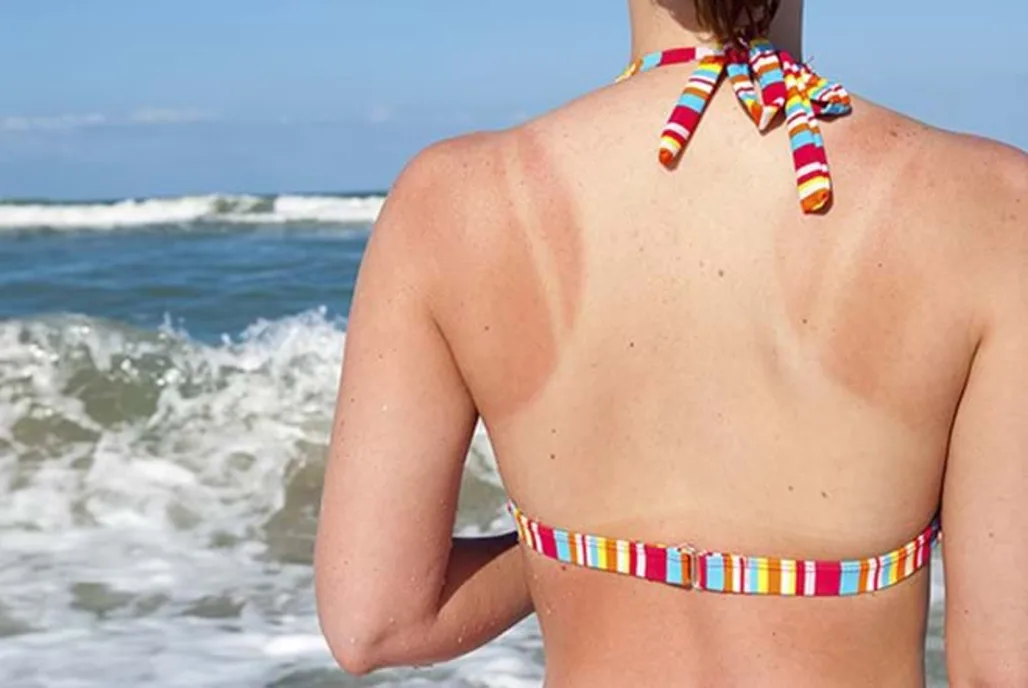 Liệu trình chăm sóc da body trắng mượt cho ngày hè tự tin